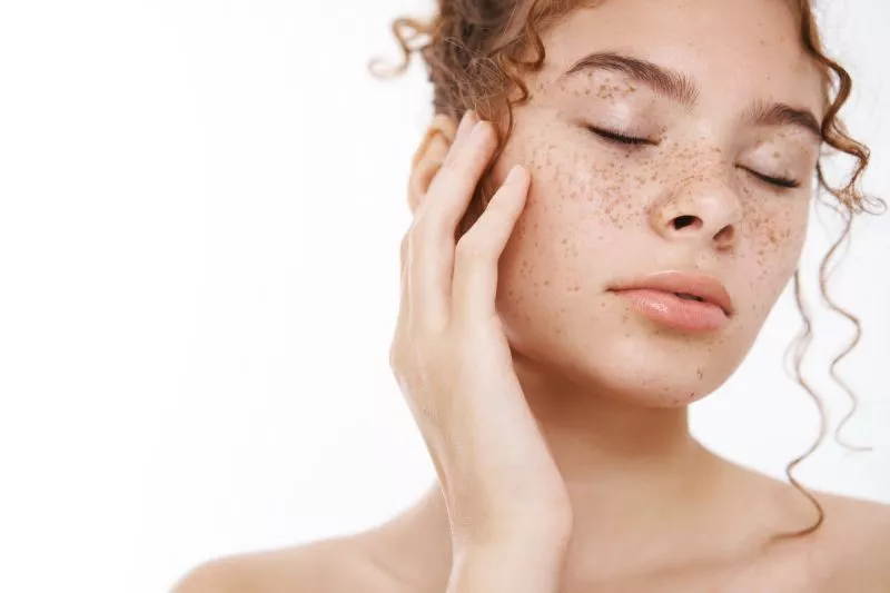  Fakta Menarik Seputar Freckles yang Perlu Kamu Ketahui