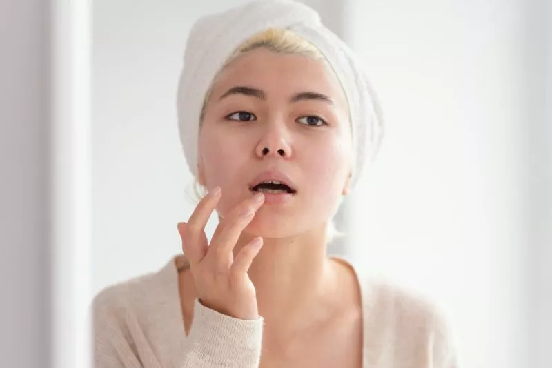 Tips Mudah Mengatasi Bibir Pecah-pecah