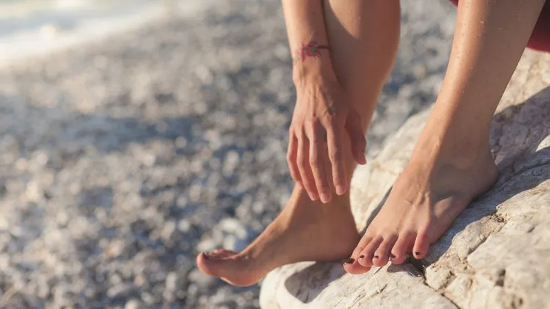 High Arch Feet,  Lengkungan yang Tinggi Pada Telapak Kaki