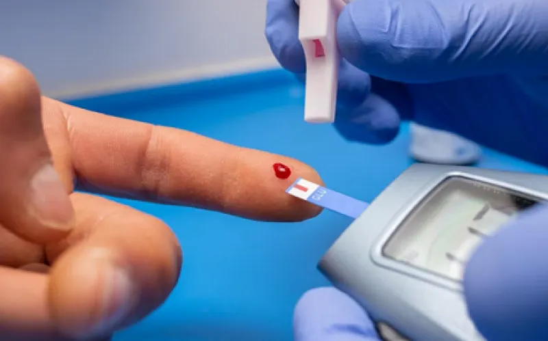 Yang Perlu Kamu Ketahui tentang Kolesterol Tinggi