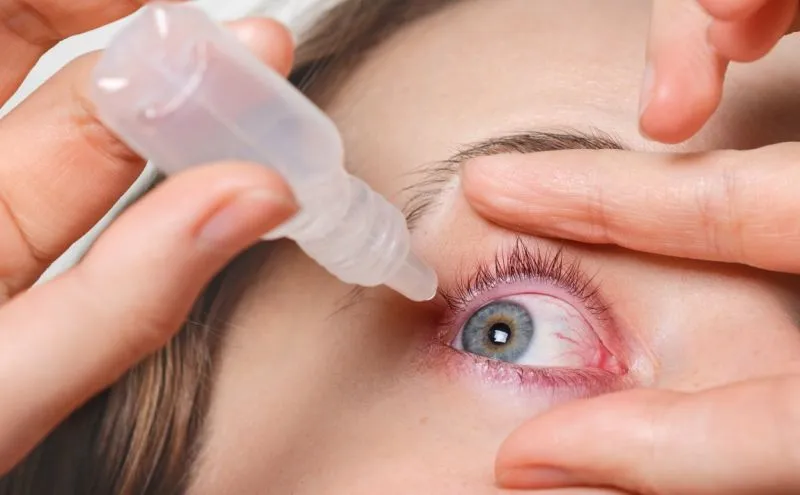 5 Penyebab Mata Kuning: Segera Periksa ke Dokter