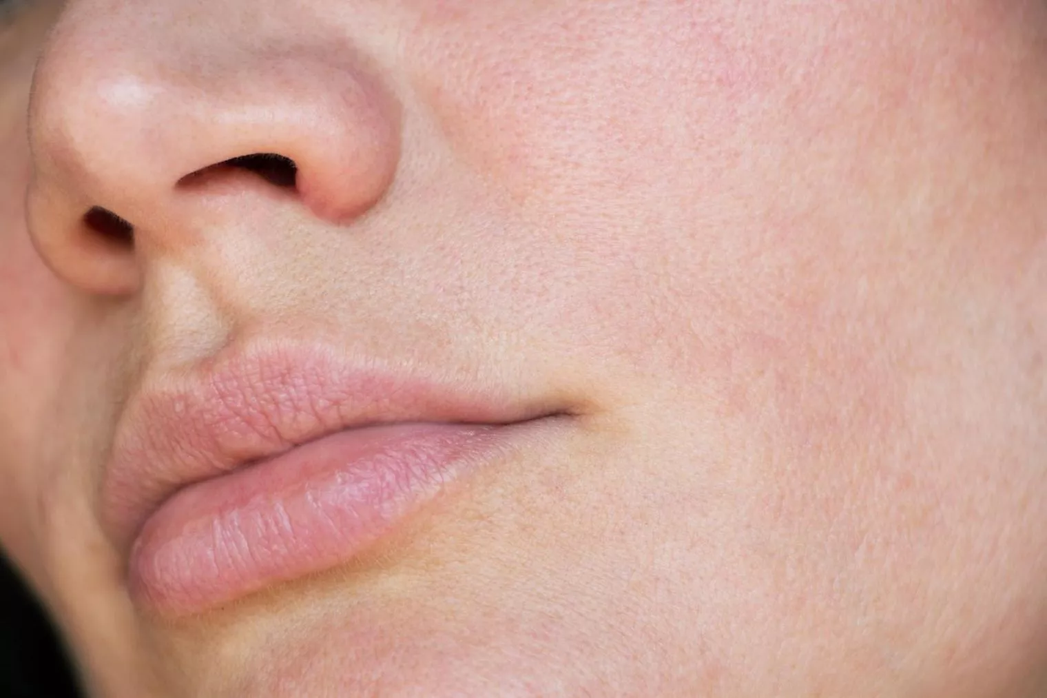 Beauty Fact: Pori-pori Tidak Bisa Benar-benar Mengecil