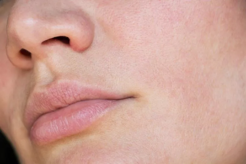 Beauty Fact: Pori-pori Tidak Bisa Benar-benar Mengecil