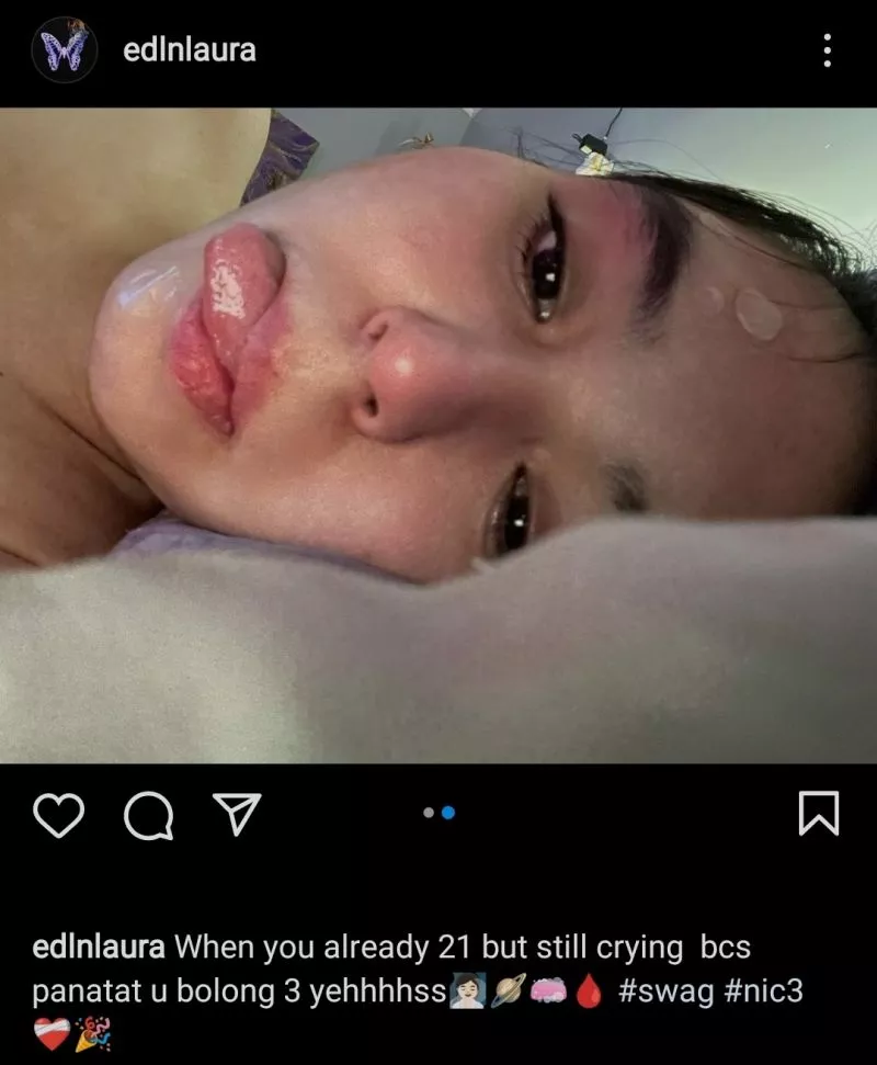 Laura Anna Sering Mengeluhkan Ulkus Dekubitus Sebelum Meninggal