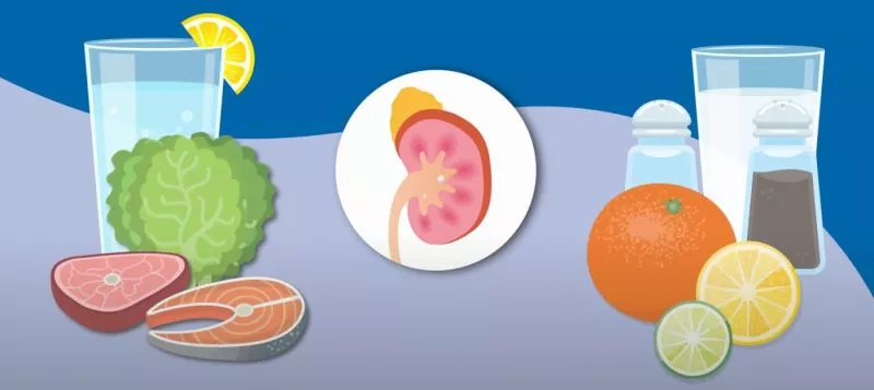 Tips Agar Terhindar Dari Batu Ginjal